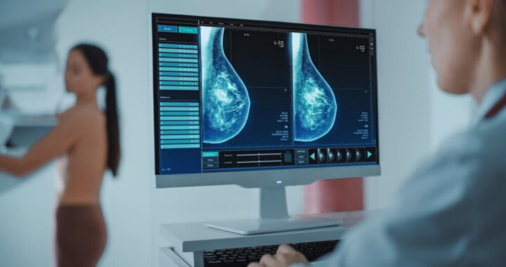 England’s NHS Launches AI Trial for Breast Cancer Screening