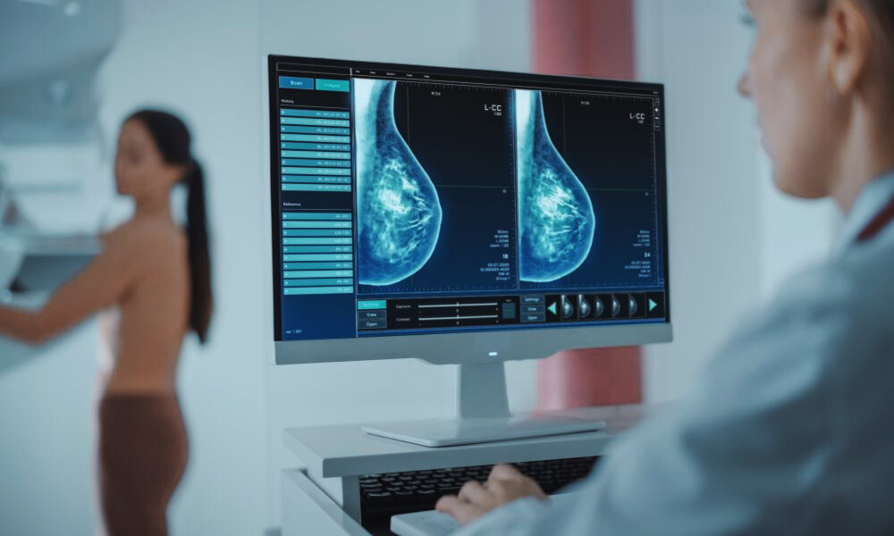 England’s NHS Launches AI Trial for Breast Cancer Screening