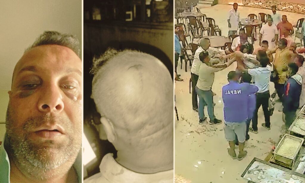 Birgunj Ward Chairperson Assaulted, Police Involvement Alleged