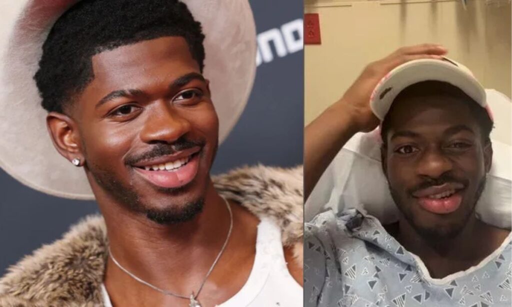 Lil Nas X Hospitalized with Facial Paralysis, Shares Emotional Update