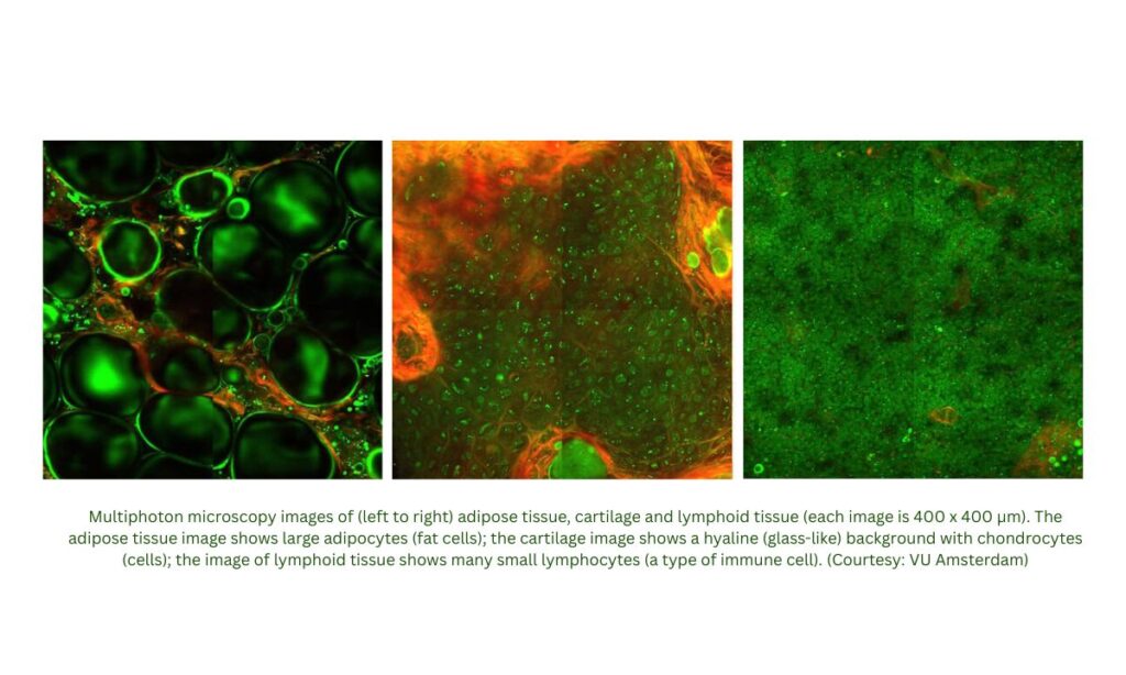 Revolutionizing Cancer Diagnosis with Simultaneous Two- and Three-Photon Imaging
