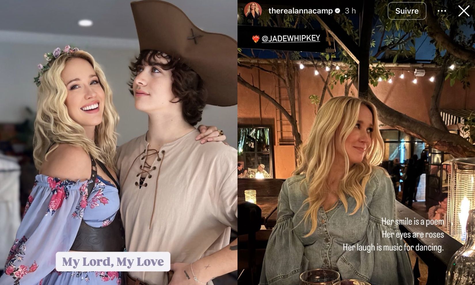 Anna Camp