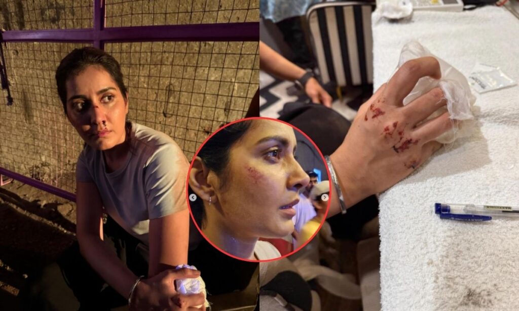 “When You Become the Storm…” Raashii Khanna Appears Badly Injured