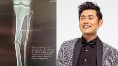 Actor Sonam Topden Breaks Leg While Shooting ‘Airi’, Filming Now Delayed